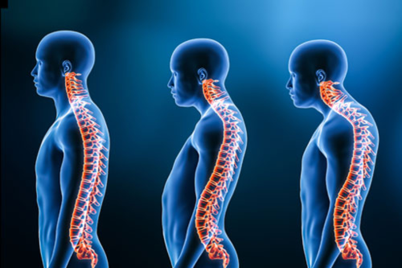 Spinal Deformities- Sinhagad Road, Swargate & Parvati Pune