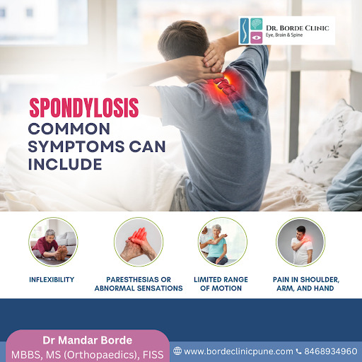 Understanding the Symptoms of Spondylosis and When to Get Help