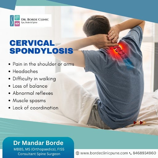 Understanding Cervical Spondylosis: Symptoms and Treatment Options